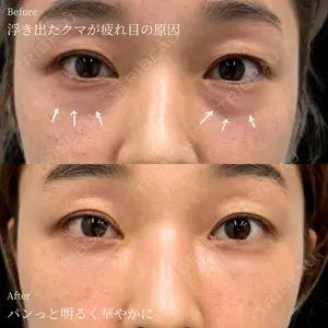 INO BEAUTY CLINIC 井上 紘基医師の症例