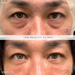 INO BEAUTY CLINICの症例