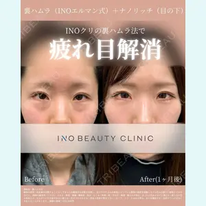 INO BEAUTY CLINIC 井上 紘基医師の症例