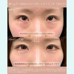 INO BEAUTY CLINIC 井上 紘基医師の症例