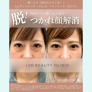 INO BEAUTY CLINIC 井上 紘基医師の症例