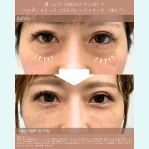 INO BEAUTY CLINIC 井上 紘基医師の症例