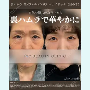 INO BEAUTY CLINIC 井上 紘基医師の症例