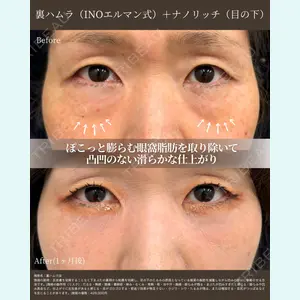 INO BEAUTY CLINIC 井上 紘基医師の症例