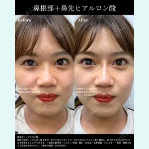 INO BEAUTY CLINIC 井上 紘基医師の症例