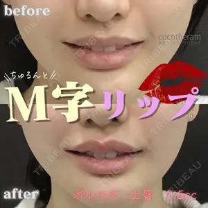 症例