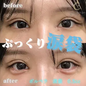 症例