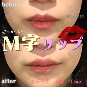 症例