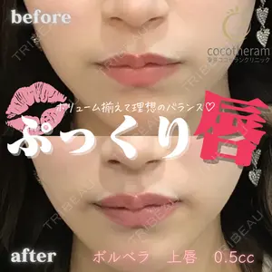 症例