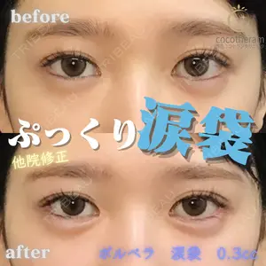 症例