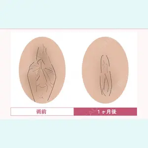 症例