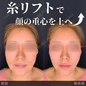 Brandnew Beauty Clinicの症例
