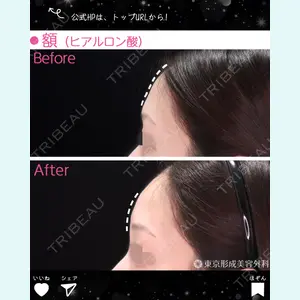 東京形成美容外科 銀座院 中尾 真紀医師の症例
