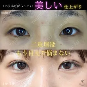 東京BELLEZZAクリニック 根本 尚久医師の症例