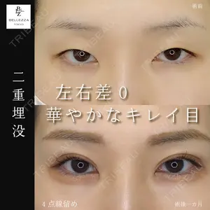 東京BELLEZZAクリニック 根本 尚久医師の症例