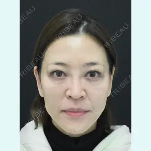 湘南美容クリニック 名古屋駅本院 高川 裕也医師の症例