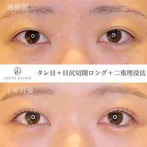 LOUIS CLINIC 二子玉川院【ルイクリニック】 小松 塁医師の症例