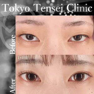 Tokyo Tensei Clinic 新宿院 沖津 勇気（ブレイブ沖津）医師の症例