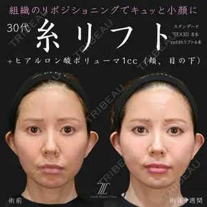 Zetith Beauty Clinic 福岡院 荻野 活医師の症例