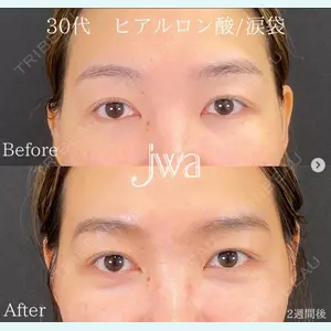 自由が丘ウェルエイジングビューティークリニック 福田 知佐子医師の症例