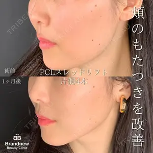 Brandnew Beauty Clinicの症例