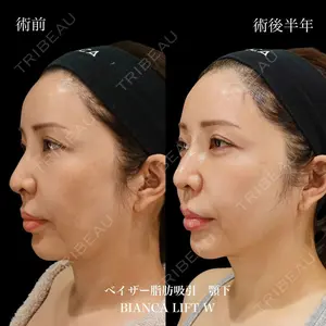 BIANCA銀座 雜賀 俊行医師の症例