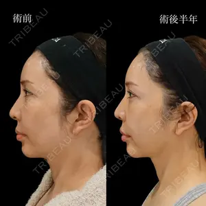 BIANCA銀座 雜賀 俊行医師の症例