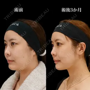 BIANCA銀座 雜賀 俊行医師の症例