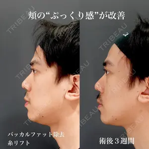 BIANCA銀座 雜賀 俊行医師の症例