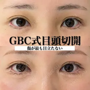 グローバルビューティークリニック 銀座院 理事長　杉崎　裕斗医師の症例