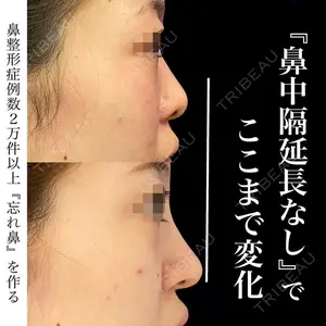 グローバルビューティークリニック 銀座院 理事長　杉崎　裕斗医師の症例