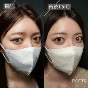 ROOTS Clinic 郭 天元医師の症例