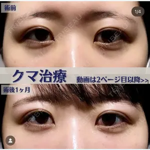 症例