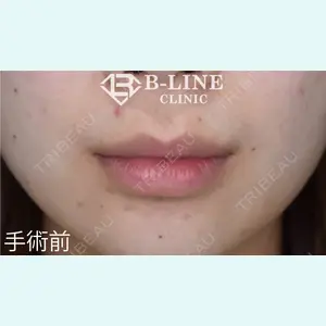 B-LINE CLINIC 池袋院 小池 康弘医師の症例