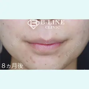 B-LINE CLINIC 池袋院 小池 康弘医師の症例