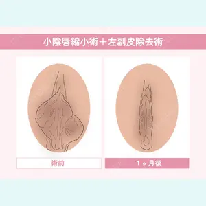 症例