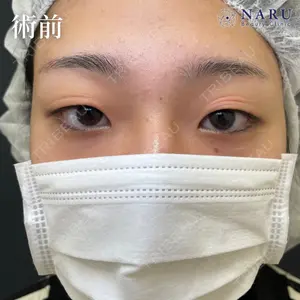 NARU Beauty Clinic 【ナルクリ】 地引 輔医師の症例