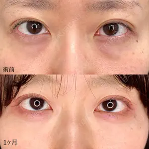 東京シンデレラ美容外科 大宮院の症例