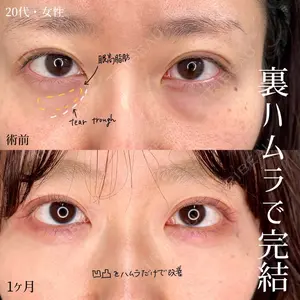 東京シンデレラ美容外科 大宮院の症例