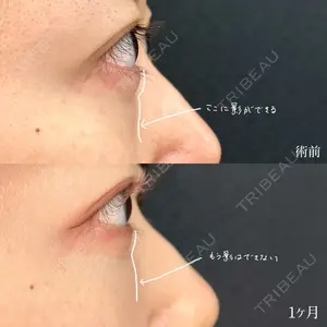 東京シンデレラ美容外科 大宮院の症例