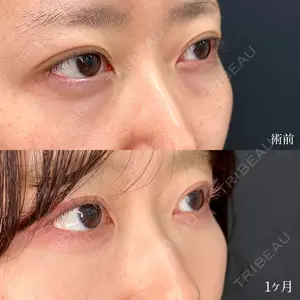 東京シンデレラ美容外科 大宮院の症例