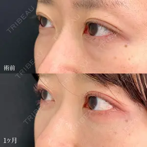 東京シンデレラ美容外科 大宮院の症例
