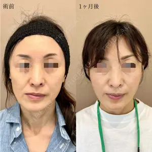 TCB東京中央美容外科 水戸院 天白 典秀医師の症例