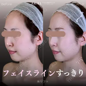 アリエル美容クリニック 郡山院の症例