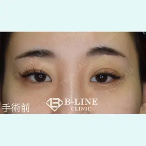 B-LINE CLINIC 池袋院 小池 康弘医師の症例