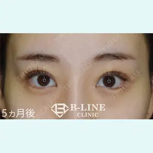 B-LINE CLINIC 池袋院 小池 康弘医師の症例