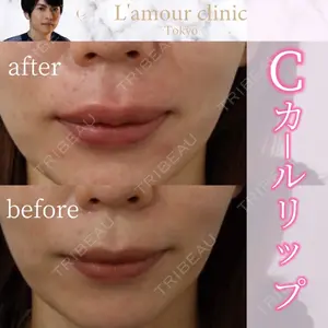 L‘amour clinic Tokyo【ラムールクリニック東京】の症例