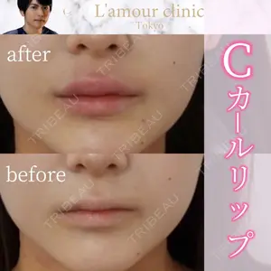 L‘amour clinic Tokyo【ラムールクリニック東京】の症例