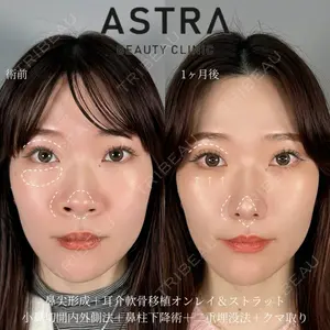 ASTRA BEAUTY CLINIC 塩満 惠子医師の症例