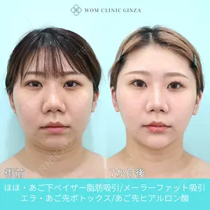 WOM CLINIC GINZA （ワム クリニック ギンザ） 深堀 純也医師の症例